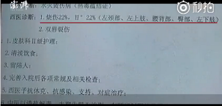 【ky.com】立夏要吃点营养的食材，把这两种工具，倒入锅中